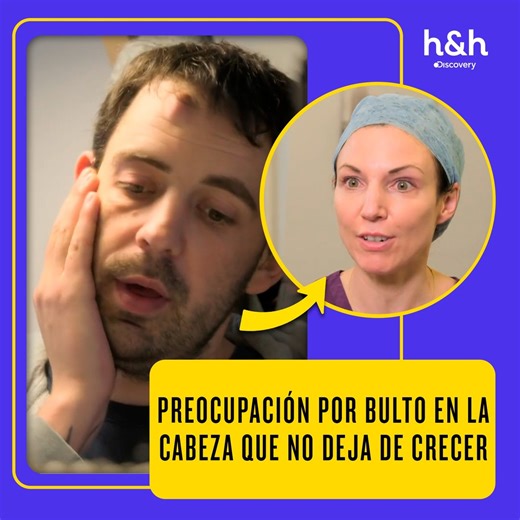 Aumento constante de un bulto en la cabeza genera alarma y urge una revisión inmediata 😟🔥 #ClínicaDeLaPiel Descubre más contenidos como este en #HBOMax Suscríbete ahora https://bit.ly/MAX-HHLAT | Discovery Home & Health