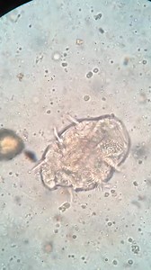 144K views · 1.4K reactions | Fecal direct mount ❤️ #microscope #lablife | Lab life | Facebook