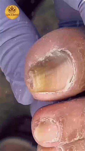 13K views · 115 reactions | 592. Small kitchen food label reading for wellness #FoodLabelTips #HeartHealthyDiet #SmartNutrition | LOS A-T BOYZ | Facebook