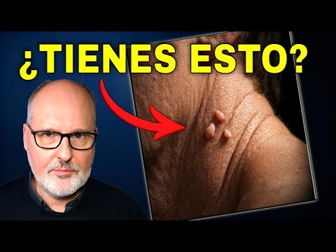 Estas Marcas en Tu Cuello Avisan de Algo Serio (y NO es la edad)
