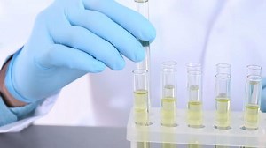 Wird mit dem Urin ausgeschieden: Was ist Harnstoff (Urea)?