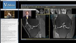 Reading ACL MRIs: Case Based Tips