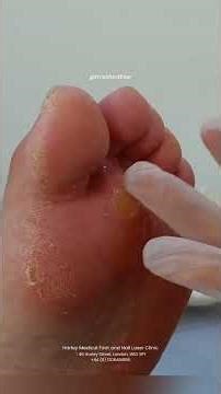 Initial assessment first! 👣