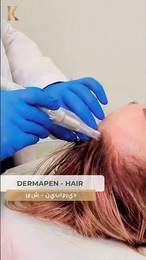 Dermapen Microneedling for Hair - Dr Khaled Al Nuami Specialized Clinic