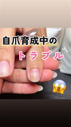 感染を引き起こす原因と対策