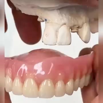 The InstaSmile™ removable dental prosthesis system is the ideal solution to regain a radiant smile in minutes. ✅ Perfect smile in just 3 minutes ✅ Light, comfortable and natural all day ✅ Easy and affordable alternative to expensive dental treatments Order yours now 👇 | The Skin Science Lab