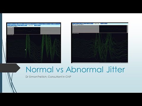 Normal Jitter vs Abnormal Jitter