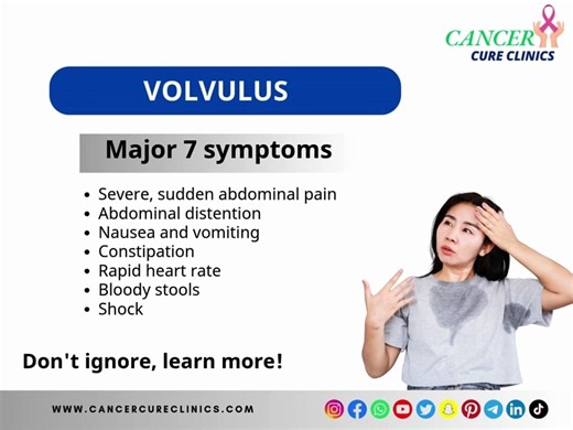 Volvulus: Symptoms, Causes, Diagnosis & Emergency Treatment of Intestinal Twisting Explained
