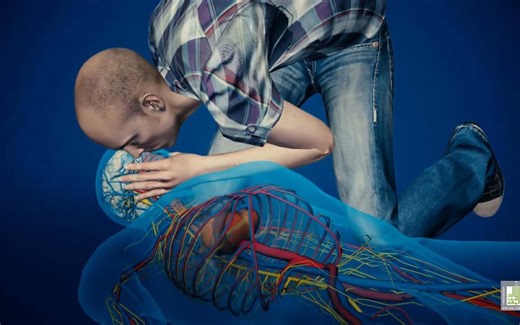 医学动画 - 心肺复苏术 CPR