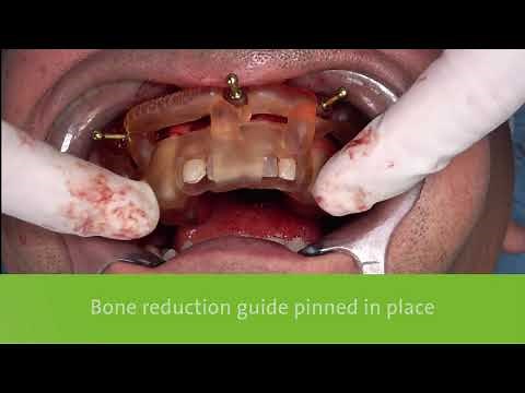 Smile in a Box Overview