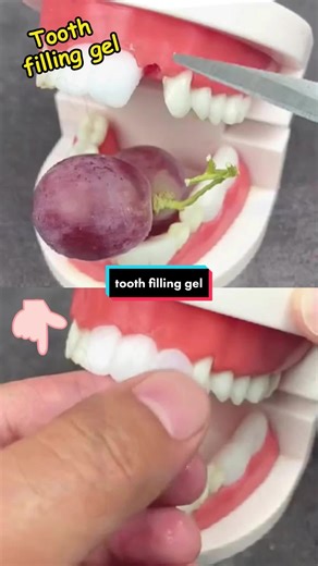 DIY Tooth Filling Gel: Safe, Non-Toxic, and Durable!