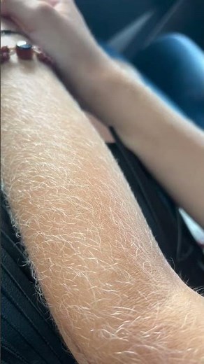 Woman With BLONDE Very Hairy ARMS