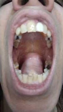 Good Happy Monday #uvula #rock dangles #mouth #nostrils #teeth #tongue tour
