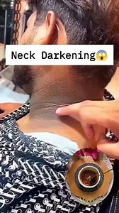 11K views · 56 reactions | Neck Cleaning Tips | Remove Neck Darkness & Tanning Instantly . . . #neckcleaningtips #neckdarknessremoval #darkness #tanning #tanningremoval #skincare #reelsviralシ #reelsvideoシ #fbreelsfypシ゚ #fblifestyles | Back to nature remedy | Facebook