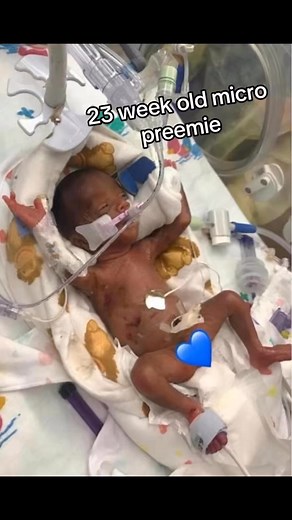 2K views · 71 reactions | My 7 yo old 1lb 3oz23 week old...