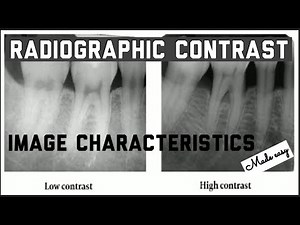 RADIOGRAPHIC CONTRAST II IMAGE CHARACTERISTICS II IDEAL RADIOGRAPH II ORAL RADIOLOGY