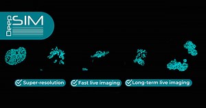 Live-cells details and dynamics with structured illumination microscopy - CrestOptics