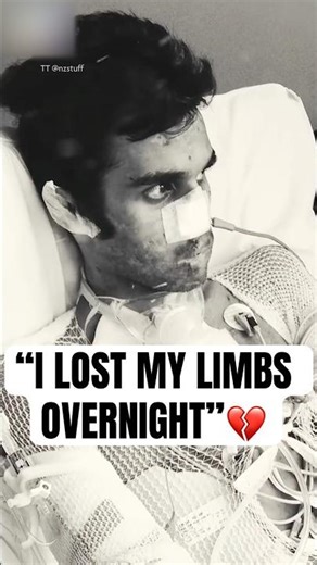 "I Lost My Limbs Overnight" #shorts #Amputation #BionicLegs