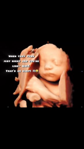 Every scan comes with a surprise 🥹They move. They stretch. They show off. And every second is pure cuteness (and a little comedy).📲 Nashville Southern KY | At-home ultrasounds that make pregnancy feel real. 🤍#AtHomeUltrasound #FunnyBabyMoments #PregnancyHumor #BabyOnTheWay #KicksAndFlutters #PregnancyJourney #peaceofmind #momtobe #nashvillemoms | Kicks and Flutters Home Ultrasound