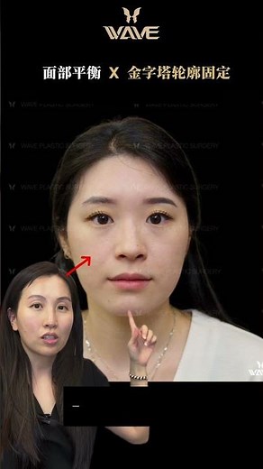 面部平衡美学有多重要！？ 想要脸部轻盈，找到你的面部平衡点是重点！