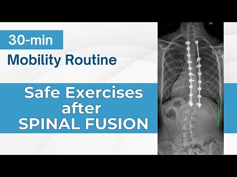 30 MIN Mobility Routine: Best Exercises & Stretches After Spinal Fusion- Improve Your Flexibility