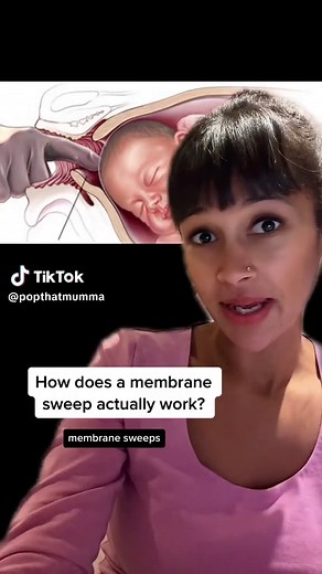 Membrane Sweep Explained: Induction of Labour Tips