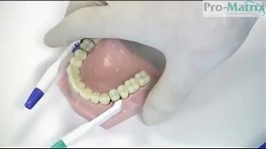 25 reactions | Astek Pro-Matrix Bands Pro-Matrix uses a straight...