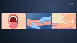 Video: Drug Delivery: Overview