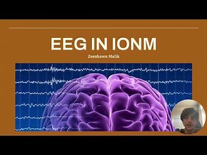 Electroencephalography [EEG]