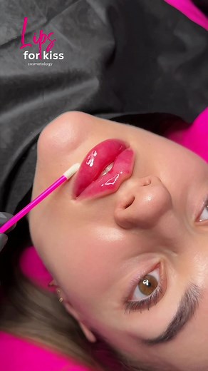 Defined Lip Contours and Aesthetic Treatments