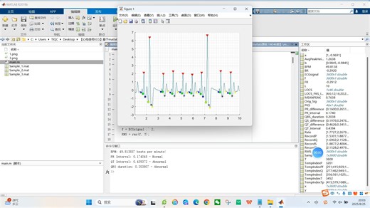 【心电信号ECG】基于matlab心电图ECG心率监测器（含PR QT QRS）【含Matlab源码 14046期】