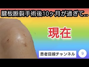 【患者目線 チャンネル9】左肩腱板断裂手術を受けて10ヶ月が経過した今現在…。