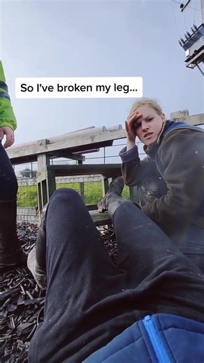 so I've broken my leg 🤦🏻‍♀️#accident #brokenleg #equestrian #ohdear #brokenankle #fall #ouch #foryou #injury #horses #horsesoftiktok #sendhelp #fail #nelsonandthegang