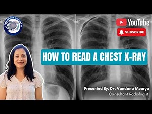 How to Read a Chest X-Ray: Step-by-Step Systematic ABCDE Method