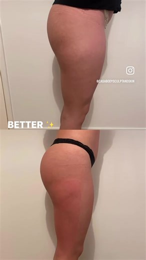 Lisa | Casa Body Sculpt & Skin on TikTok