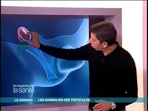 Les Anomalies Testiculaires