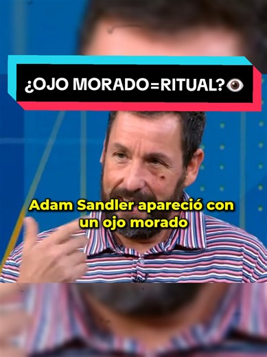 Adam Sandler, Elon Musk, Bad Bunny, Robert Downey Jr… y muchos más. Todos han aparecido con un ojo morado, casi siempre el izquierdo. Siempre la misma explicación: accidente, golpe, caída. ¿Casualidad que sean tantos? ¿O hay un patrón que vale la pena cuestionar? ¿Qué sientes tú al ver estas imágenes? ¿Solo mala suerte… o algo más nos están mostrando? Cuéntame en comentarios tu teoría o si has notado lo mismo en otros famosos… leo todos y el que más me mueva lo menciono en el siguiente video 👇 