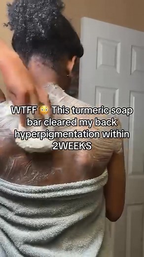 1.8K views | Back hyperpigmentation? CLEARED in 2 weeks. 識✨ She used our Turmeric Soap and stayed consistent—and now her back is smoother, brighter, and so even-toned. It’s giving results, not promises. If it worked for her, it can work for you too  #RichAndClear #TurmericSoapTruths #BackAcneFix #HyperpigmentationGone | Rich & Clear Skincare | Facebook