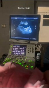 14 reactions | Embryo Transfer 醙 #familyivf #infertilityawareness #embryotransfer #embryotransfer #preganncy #fertilitycentre #ivftechnology #femalefertility #familyplanning #ivf | Family IVF | Facebook
