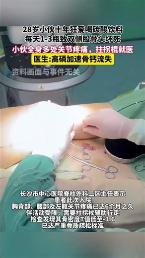 28岁小伙十年狂爱喝碳酸饮料，每天1-3瓶致双侧股骨头坏死，小伙全身多处关节疼痛，拄拐棍就医。医生高磷加速骨钙流失#碳酸饮料 #钙流失 #钙