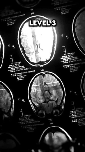 Phobia Test: Nosocomephobia #fyp #phobia #nosocomephobia #test