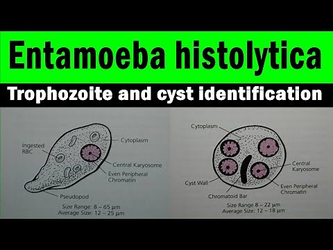 Entamoeba histolytica trophozoite and cyst | microscopic view ((with identification features)