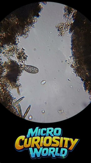 Same Microorganism, Two Lighting Techniques | What Is It?
