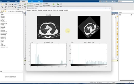 基于Matlab的医学图像处理系统