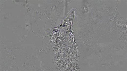 3.7K views · 154 reactions | While looking through a desktop water sample, I saw THIS! Never seen the death of a ciliate like this-- usually it's too much pressure from the coverslip or too much osmotic pressure. But this gradual posterior-to-anterior effect amazed me -- I am guessing some chemical or toxin diffusing across the cell. If anyone has special insight, I'd love to hear it! Motic BA310e - 40x Objective - sped up 2X | John S Mead | Facebook