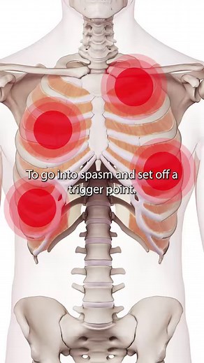 3.3K views · 60 reactions | The Intercostal Muscle Trigger Points #muscle #triggerpoints #intercostal #ribpain For more information about NAT online courses, please visit www.nielasher.com | NAT Global Campus | Facebook