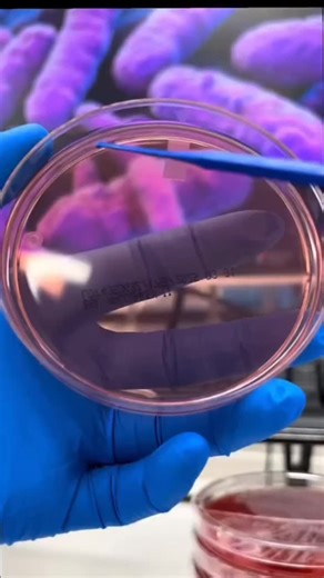 Microbiologist Ram Sahu on Instagram: "Common steps for isolation of bacteria from water Sample collection: Collect a water sample in sterile containers, ideally after running the water for a few minutes to get a fresh sample. Serial dilution: Serially dilute the water sample using a sterile diluent (like water or saline) to reduce the number of bacteria, making it easier to isolate single colonies. Plating: Spread a small, known volume of the diluted sample onto different types of agar plates, 