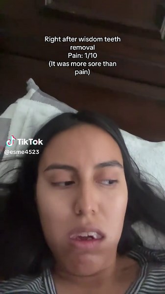 Wisdom Teeth Removal Journey: Day 12 Update