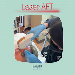 Advanced Fluorescence Technology, also known as AFT, is a laser rejuvenation treatment used to remove sun damage and treat conditions worsened by it, such as rosacea. Redness, hyperpigmentation on the skin, and damaged capillaries are all targets for this procedure. To schedule your consultation for AFT, please call (314)743-3300 #laserAFT #medicalgrade #correction #stlmedspa #parkcrestplasticsurgery #theaestheticscenter #antiaging #stlmedspa #stlplasticsurgery #photofacial #aft #advancedfloures