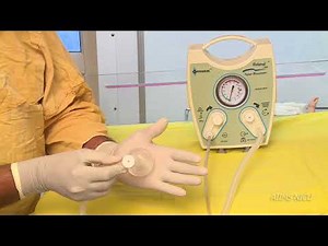 CPAP in delivery room using T Piece